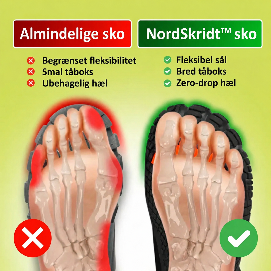 SÆRPRÆGET