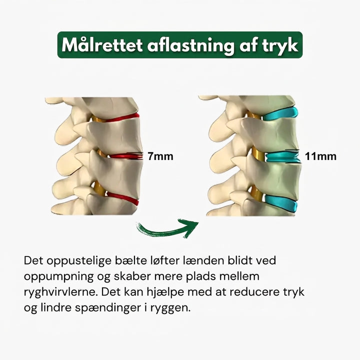 SÆRPRÆGET