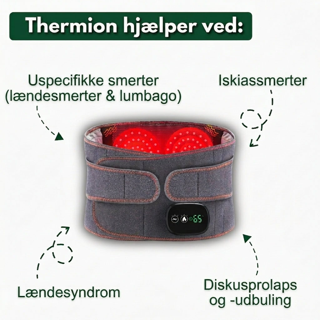 SÆRPRÆGET